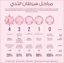 سرطان الثدي وأسبابه وطرق فحصه بانتظام وكيفية الوقاية منه